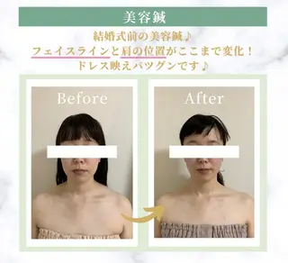 美容鍼灸師 齋藤 麗子のエステ・リラクイメージ