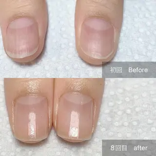 ネイル 木村 千晴のネイルデザイン