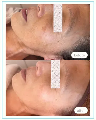 🌞シミケアサロン @SUNiko🌴のエステ・リラクイメージ