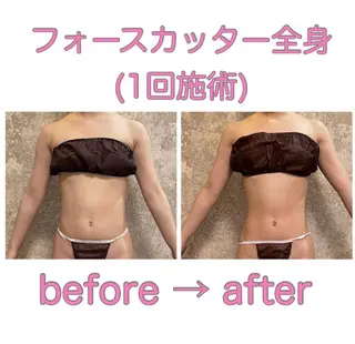 痩身/美肌/脱毛 MAX BEAUTYのエステ・リラクイメージ