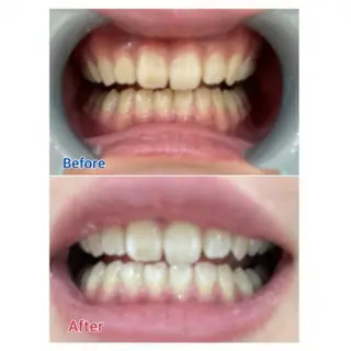 M渋谷店所属・Ｍ渋谷 ホワイトニングのエステ・リラクイメージ