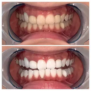 メンズ ライトビューティー 錦糸町店のエステ・リラクイメージ