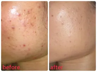 美SORA ～ｳﾞｨｿﾗ～のネイルデザイン