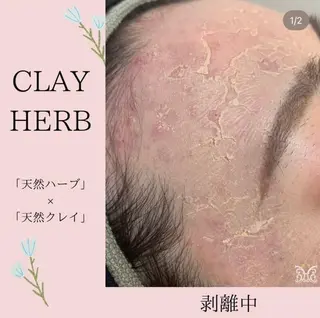 【剥離ありハーブピーリング専門エステ】cerisier BEAUTÉ 原宿所属・cerisier BEAUTÉのエステ・リラクイメージ