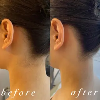 うなじ脱毛/美肌脱毛 LABELのエステ・リラクイメージ