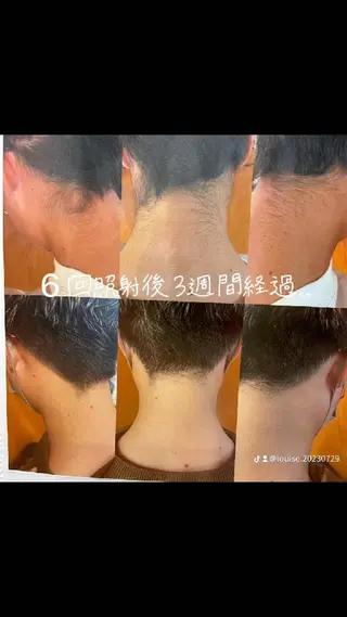 LOUISE.／脱毛所属・LOUISE. ／脱毛のエステ・リラクイメージ