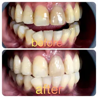 two nailのネイルデザイン