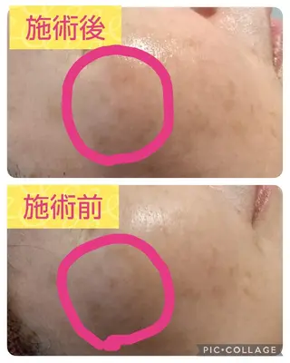 viage所属・viage 脱毛&フェイシャル店のエステ・リラクイメージ