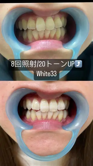 メンズ セルフホワイトニング White33大名のその他イメージ