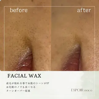 ワックス脱毛🌈 ESPOIRnocoのエステ・リラクイメージ