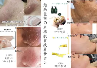 LUMINA ESTHのエステ・リラクイメージ