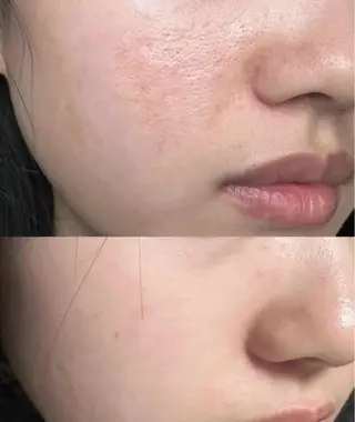 ネイル aliaハイフ&水光ジェットサロン所属・aliaハーブ水光店 エステティシャン募集のエステ・リラクイメージ