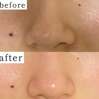 毛穴専門サロン　フルール所属・フルールFululu 自由が丘のエステ・リラクイメージ