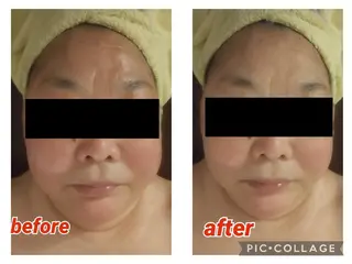 beauty salon    向日葵所属・beauty  salon 向日葵のエステ・リラクイメージ