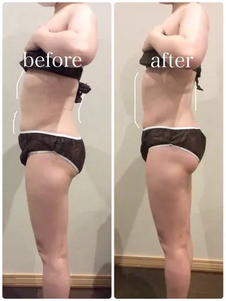 腸もみKalon銀座 オーナーひかるのエステ・リラクイメージ