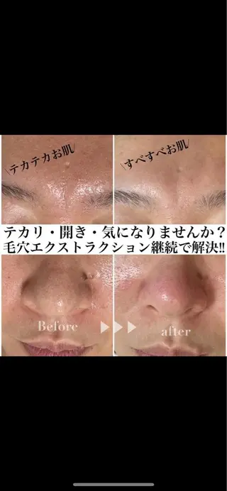 BELINDA HITOMIのマツエク・マツパデザイン