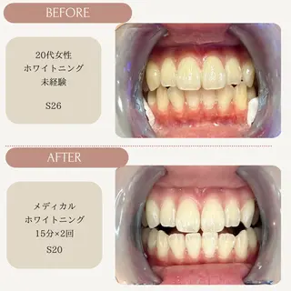 Whitening Carat 恵比寿店所属・ホワイトニング カラット 恵比寿店のエステ・リラクイメージ