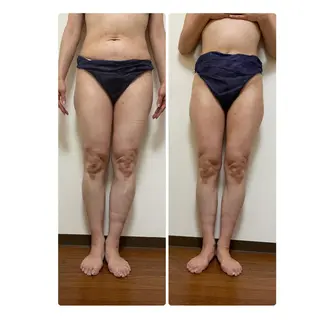 超悶絶サロンひまわり所属・村岸 恵美のエステ・リラクイメージ