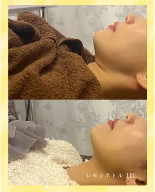 看護師が施術する小顔 サロン/KIKIのエステ・リラクイメージ