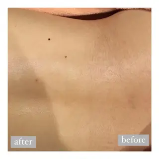 美肌脱毛専門サロン Dione栄店のエステ・リラクイメージ