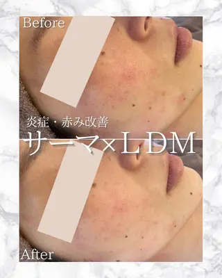 バスト専門店 Ella.所属・Ellaバストアップ &肌質改善🍃専門店のエステ・リラクイメージ