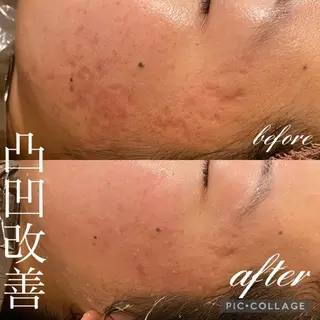 Ensor Clair所属・EnsorClair 代表　野口真央のエステ・リラクイメージ