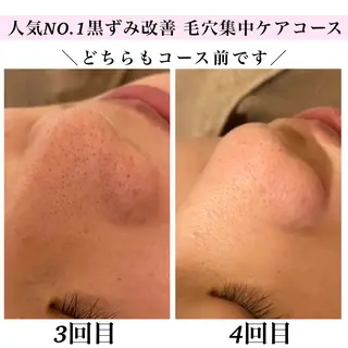 Bellesthe （ベルエステ）のエステ・リラクイメージ