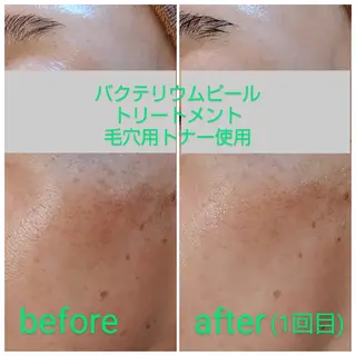 Lottie所属・Lottie リラク担当Asukaのエステ・リラクイメージ