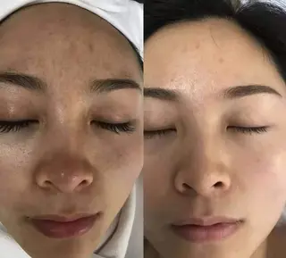 ネイル aliaハイフ&水光ジェットサロン所属・aliaハーブ水光店 エステティシャン募集のエステ・リラクイメージ