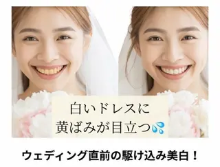 エミルカ　自由が丘店所属・ニキビ改善ハーブ🌿 ハナシマのその他イメージ