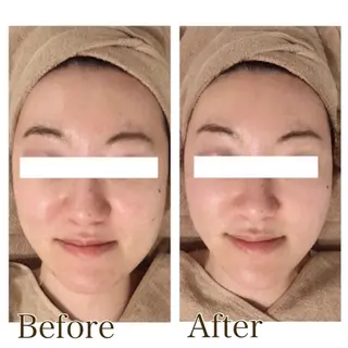 MiMiy 銀座店のエステ・リラクイメージ