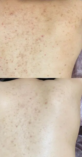 Fleur フルールのエステ・リラクイメージ