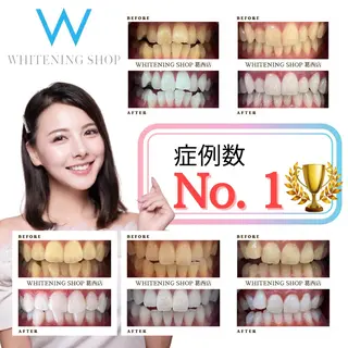 メンズ ホワイトニング ショップ葛西店のその他イメージ