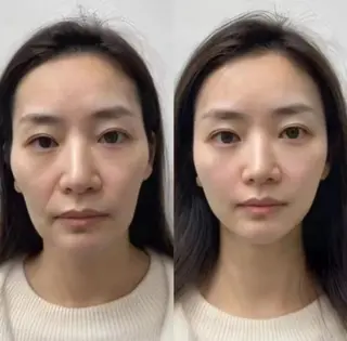 マツエク・マツパ aliaハイフ&水光ジェットサロン所属・aliaハーブ水光店 エステティシャン募集のエステ・リラクイメージ