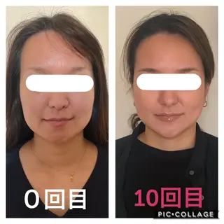 インタークロス所属・小顔矯正専門TIAM インタークロス池袋店のエステ・リラクイメージ