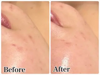 Gemini 　MIKIのエステ・リラクイメージ