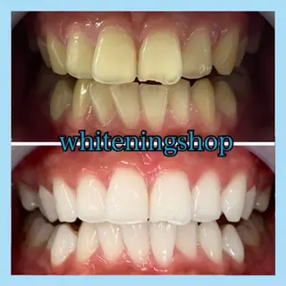 ホワイトニング ショップ千葉店のその他イメージ