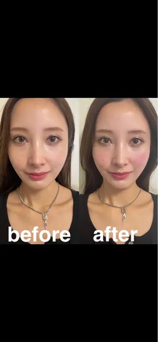 美容鍼灸サロン mahoroba院長のエステ・リラクイメージ