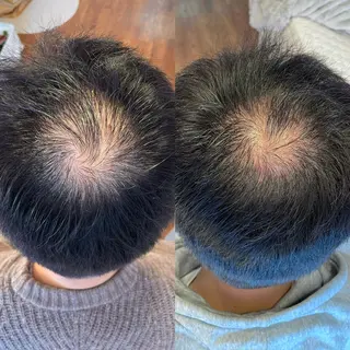 毛穴専門店MeMe.八千代店所属・\毛穴・頭皮/ のお悩みに特化💪のその他イメージ