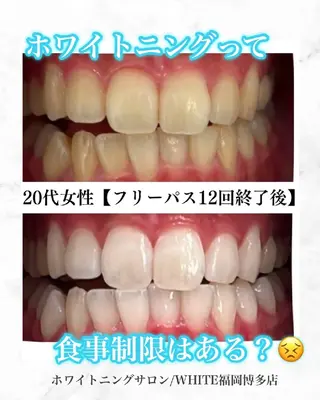 キッズ メンズ ホワイトニングサロン WHITE福岡博多店のエステ・リラクイメージ