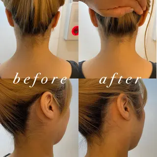 うなじ脱毛/美肌脱毛 LABELのエステ・リラクイメージ