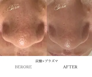 小顔・ニキビ・肌管理 TERN 南草津店のエステ・リラクイメージ