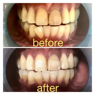 two nailのネイルデザイン