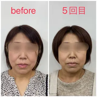 小顔矯正サロンLily所属・小顔矯正サロン Lilyのエステ・リラクイメージ