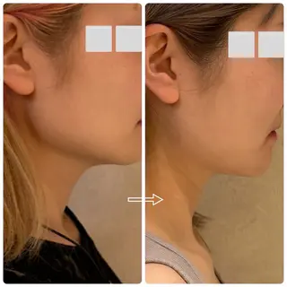 private salon.ohana所属・小顔/ララピール ohanaのエステ・リラクイメージ