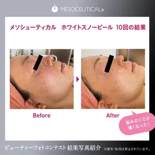 Salon de cheri サロンドシェリ人形町店所属・毛穴のお悩み・シミ 松本瞳のエステ・リラクイメージ