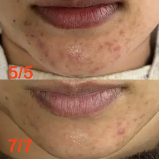 mili mili beauty salon所属・mili mili 岡本のエステ・リラクイメージ