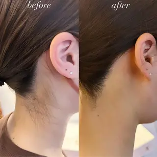 うなじ脱毛/美肌脱毛 LABELのエステ・リラクイメージ