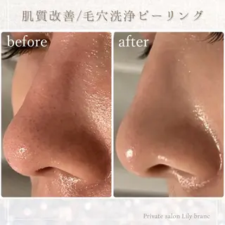 Lily branc 痩身/小顔/肌質改善のエステ・リラクイメージ