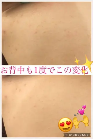 ミディアム カラー パーマ ヘアアレンジ メンズ キッズ ネイル マツエク・マツパ ニキビ・肌質改善専門 ♡人生が変わるサロンのエステ・リラクイメージ